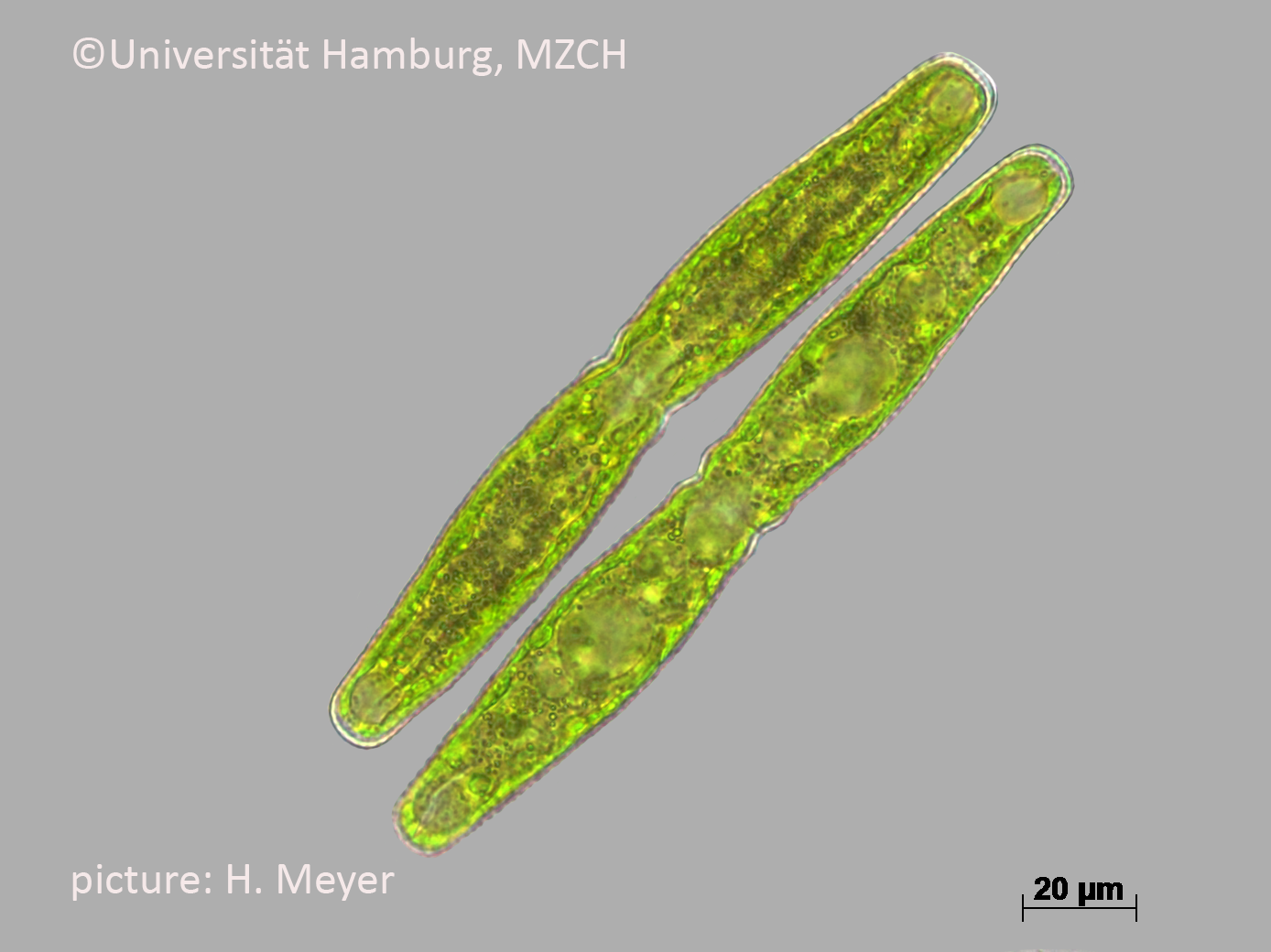 73_Pleurotaenium ehrenbergii_400x-21_H. Meyer.bmp